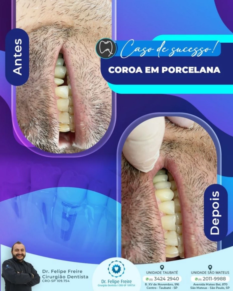 Foto 12:  — Clínica Freire