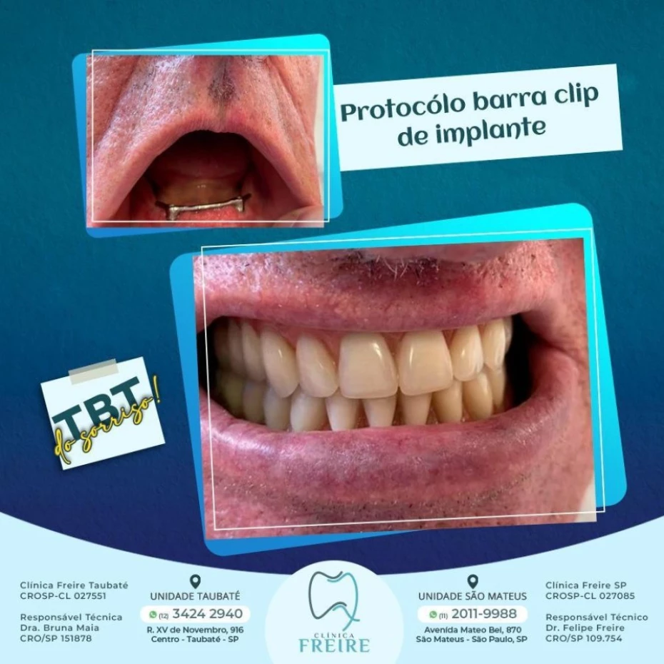 Foto 2:  — Clínica Freire